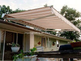 Smart Semi-Cassette Retractable Awning for Patio or Balcony (JX-RA6000)