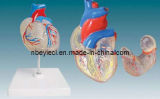 Model of Transparent Heart (EYAM-30) 