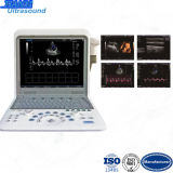 Portable Color Doppler Ultrasound Scanner Medical Equipment (TY-6868D)