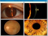 Digital Imaging System for Fundus Camera, Slit Lamp and Operating Microscope