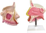 Nasal Cavity-Mh06001