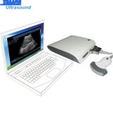 for PC USB Ultrasound Scanner with Software