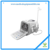 My-A002 All-Digital Ultrasound Diagnosing Equipment