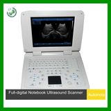 3D and PC Software Ultrasonic Scanner