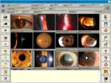 Ophthalmology Software for Slit Lamp/Microscope/Fundus Camera/Ab Scan