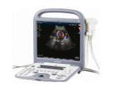 S6 Medical Ultrasound Portable Color Dopler Flow Measurement Equipment