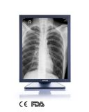 3MP 21-Inch 2048X1536 LCD Screen Monochrome Monitor, CE, FDA Approved, Angiography Equipment