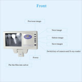 2015 Newest X Ray Film Reader with Intraoral Camera + 5inch Monitor Together