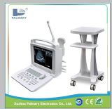 Full Digital Ultrasound Scanner/Medical Equipment