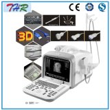 Portable Ultrasound Diagnostic Equipment (THR-US6602)