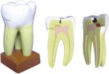 Model of Teeth-Mh06003