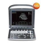 Medical Equipment Portable Digital Ultrasound Scanner