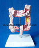 3D Anatomical Medical Colon Model (EYAM-03)