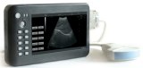 Mini Ultrasound Diagnose Instrument