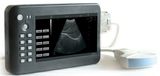 Mini Ultrasound Diagnose Instrument