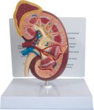 Dissection Model of Kidney-Mh07039
