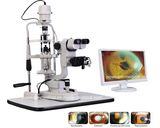 Five Steps Rotation Magnification Digital Slit Lamp with Camera (J7D)