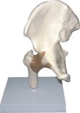 Human Hip Joint-Mh01018