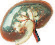 Kidney (Plastinated Specimen)