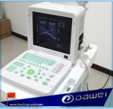 Gynecological Full Digital Equipment