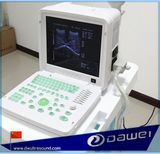 Gynecological Full Digital Equipment