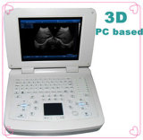 Medical Device/Full-Digital PC Handheld Ultrasound Scanner/Diagnosis Equipment