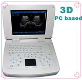 Medical Device/Full-Digital PC Handheld Ultrasound Scanner/Diagnosis Equipment