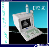 B&W Full Digital Portable 2d Ultrasound Equipment Dw330