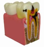 AB102 Tooth Model