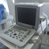 Full Digital Echo Ultrasound Machine Medical Equipment