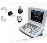3D Ultrasound Scanner Laptop Medical Equipment