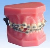 Dental Study Model