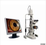 2014 New Product Digital China Slit Lamp