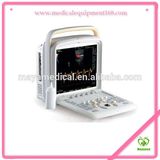 My-A025 Medical Portable Ultrasound Equipments